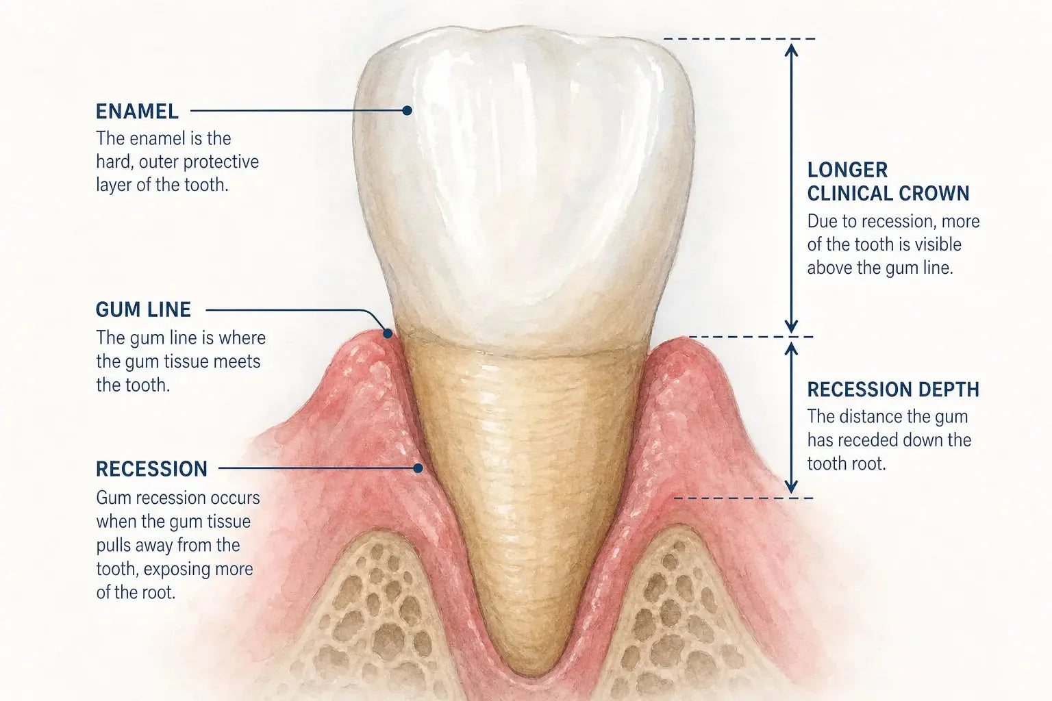 Do Electric Toothbrushes Cause Gum Recession?