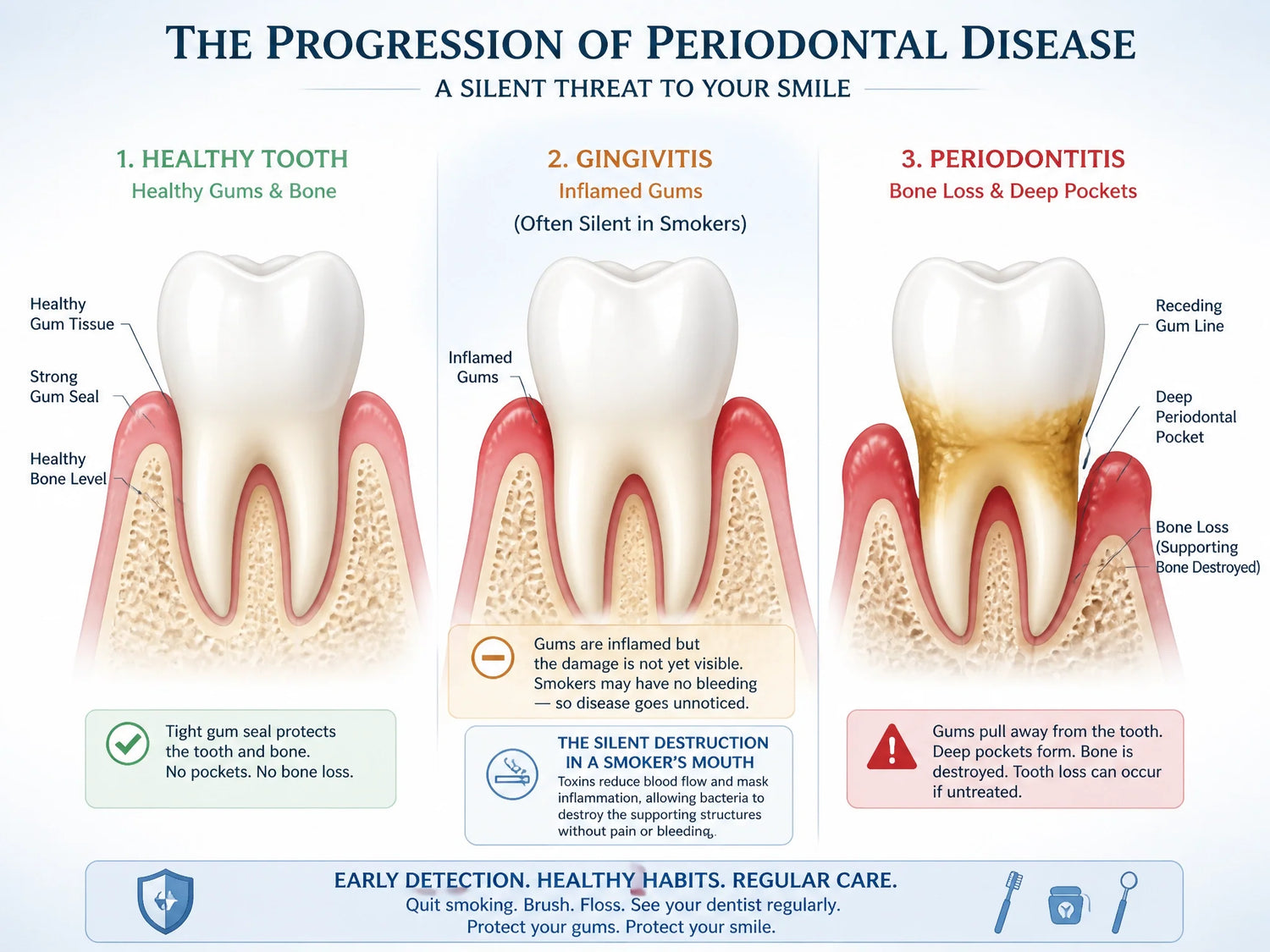 What Smoker’s Teeth Reveal: Immediate Signs and Health Risks