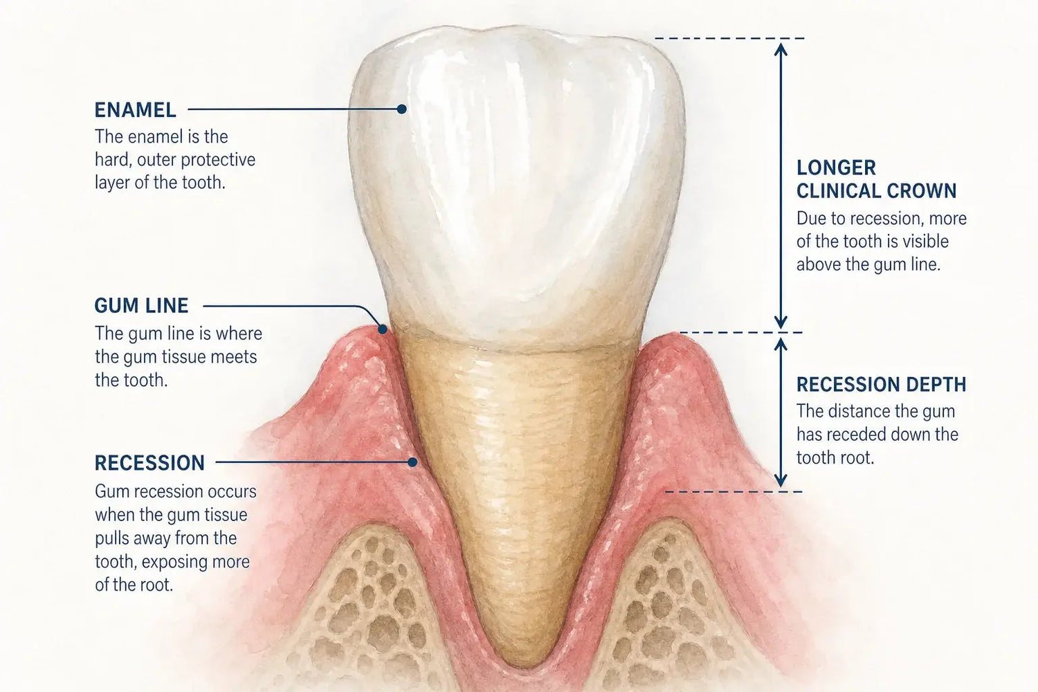 Do Electric Toothbrushes Cause Gum Recession?