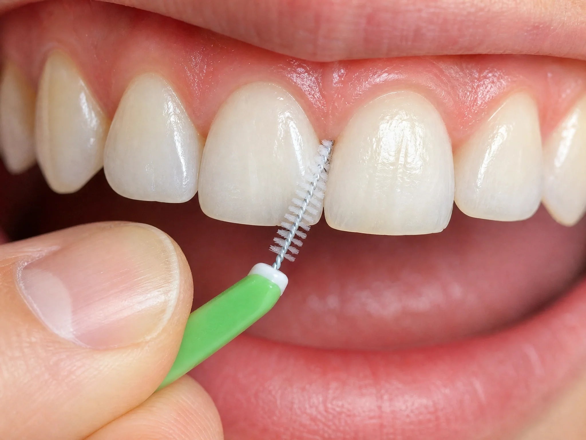 How to Use Interdental Brushes: A Step-by-Step Guide
